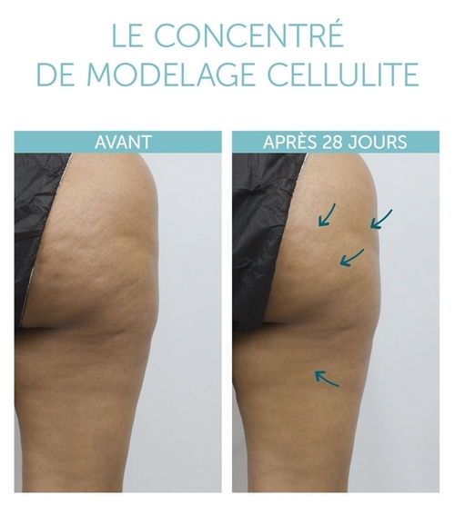Concentré de Modelage Cellulite 3